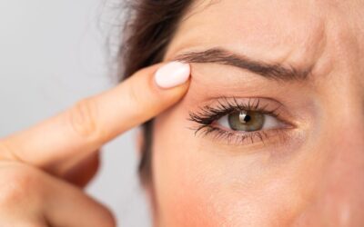 Blefaroplastica, la guida completa: quali sono i vantaggi e per chi è indicata